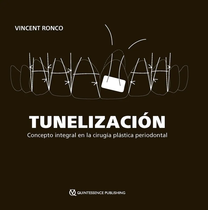 TUNELIZACIÓN. Concepto integral en la cirugía plástica periodontal
