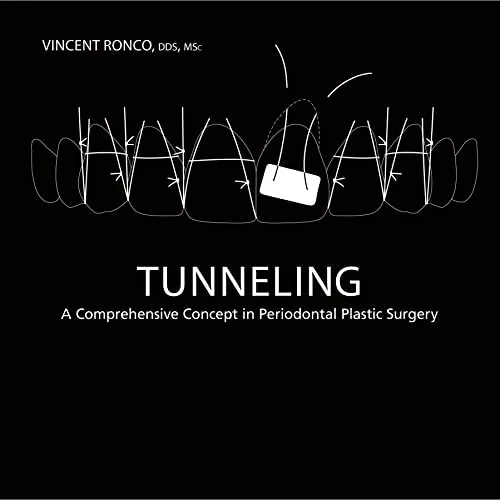 Tunneling: A Comprehensive Concept in Periodontal Plastic Surgery