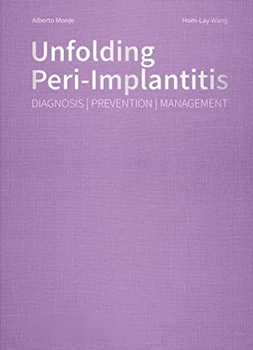 Unfolding Peri-Implantitis: Diagnosis | Prevention | Management